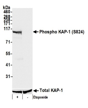 Rabbit anti-Phospho KAP-1 (S824) Antibody