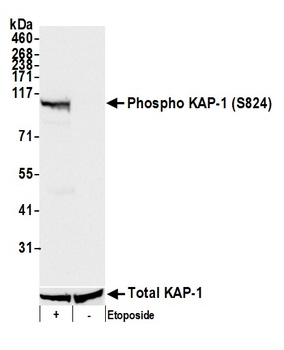 KAP-1, Phospho (S824) Antibody