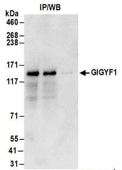 Rabbit anti-GIGYF1 Antibody