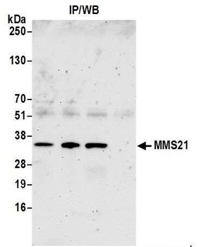 MMS21 Antibody