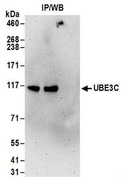 Rabbit anti-UBE3C Antibody