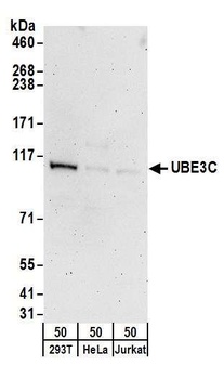UBE3C Antibody