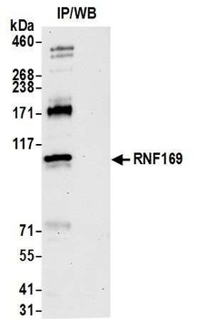 RNF169 Antibody