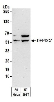 Rabbit anti-DEPDC7 Antibody