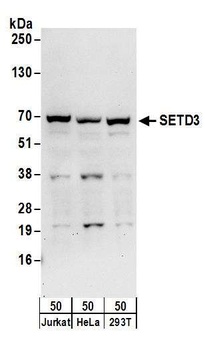 SETD3 Antibody