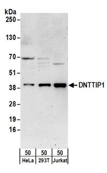 Rabbit anti-DNTTIP1 Antibody