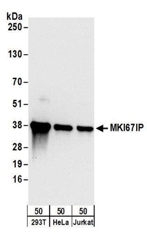 MKI67IP Antibody