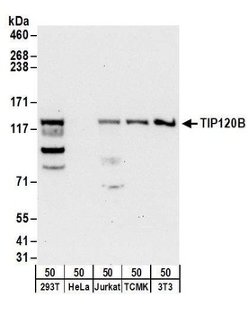 TIP120B Antibody