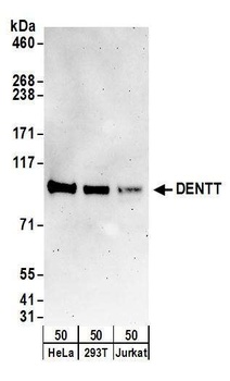 Rabbit anti-DENTT Antibody