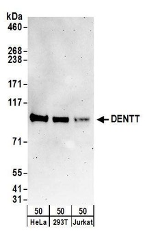 DENTT Antibody