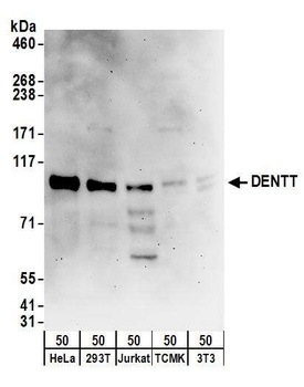 DENTT Antibody