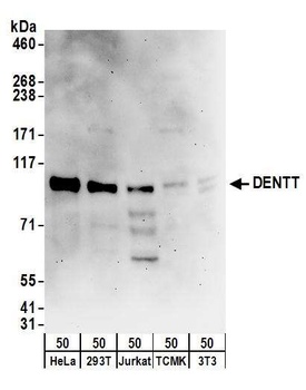 Rabbit anti-DENTT Antibody