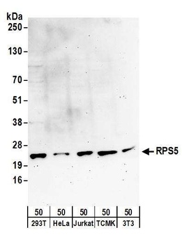 Rabbit anti-RPS5 Antibody