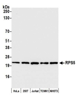 Rabbit anti-RPS5 Antibody