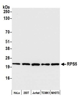 RPS5 Antibody