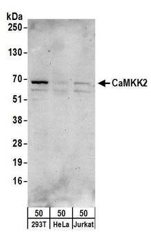 CaMKK2 Antibody