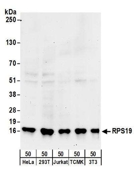 Rabbit anti-RPS19 Antibody