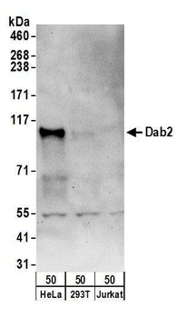 Rabbit anti-Dab2 Antibody