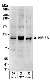 KIF18B Antibody