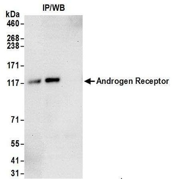 Androgen Receptor Antibody