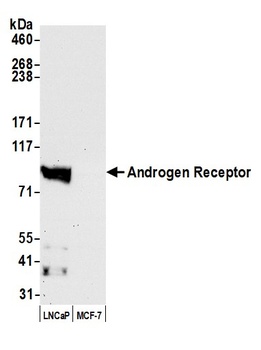 Androgen Receptor Antibody