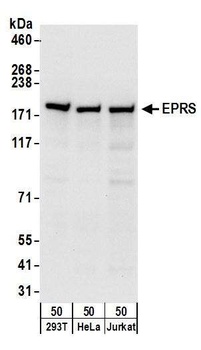 EPRS Antibody