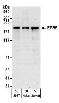 EPRS Antibody