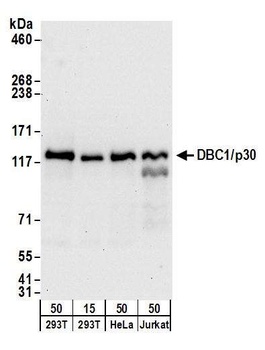 DBC1/p30 DBC Antibody