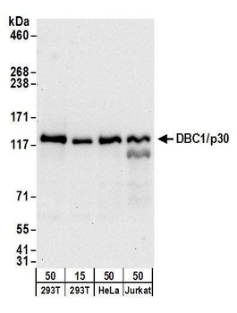 Goat anti-DBC1/p30 DBC Antibody