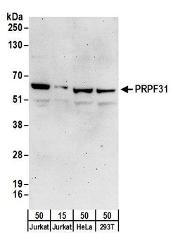 PRPF31 Antibody