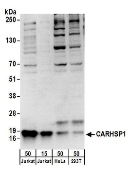 CARHSP1 Antibody