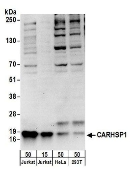 Rabbit anti-CARHSP1 Antibody