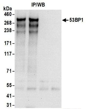 53BP1 Antibody