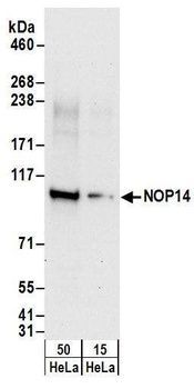 NOP14 Antibody