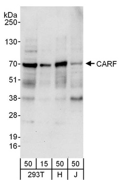 Rabbit anti-CARF Antibody
