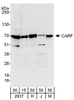 Rabbit anti-CARF Antibody