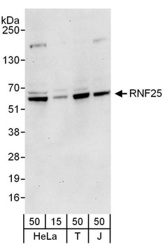 RNF25 Antibody