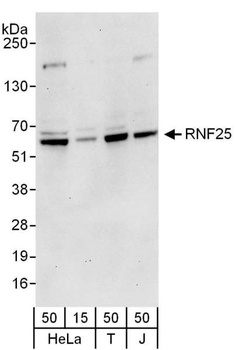 Rabbit anti-RNF25 Antibody