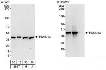 Rabbit anti-PSMD13 Antibody