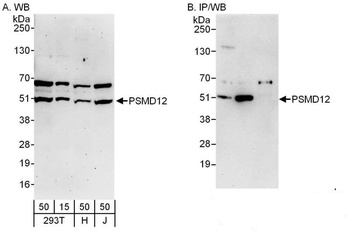 Rabbit anti-PSMD12 Antibody