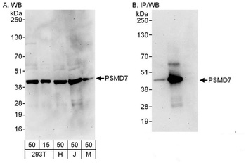 Rabbit anti-PSMD7 Antibody