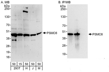 Rabbit anti-PSMC6 Antibody