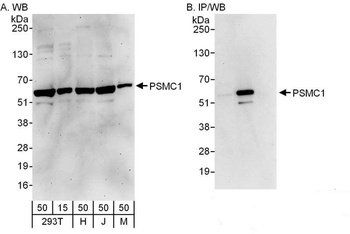 Rabbit anti-PSMC1 Antibody