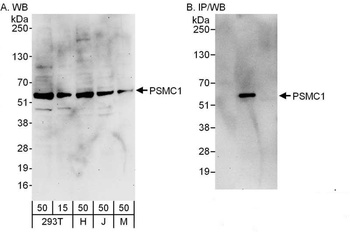 Rabbit anti-PSMC1 Antibody