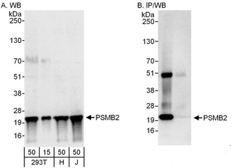 Rabbit anti-PSMB2 Antibody