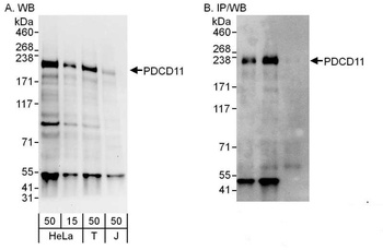 Rabbit anti-PDCD11 Antibody