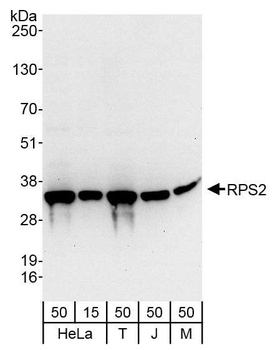 Rabbit anti-RPS2 Antibody