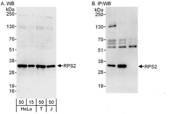 Rabbit anti-RPS2 Antibody