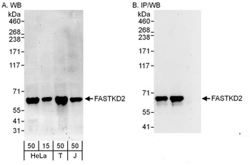 Rabbit anti-FASTKD2 Antibody