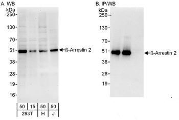 Rabbit anti-Beta-Arrestin 2 Antibody